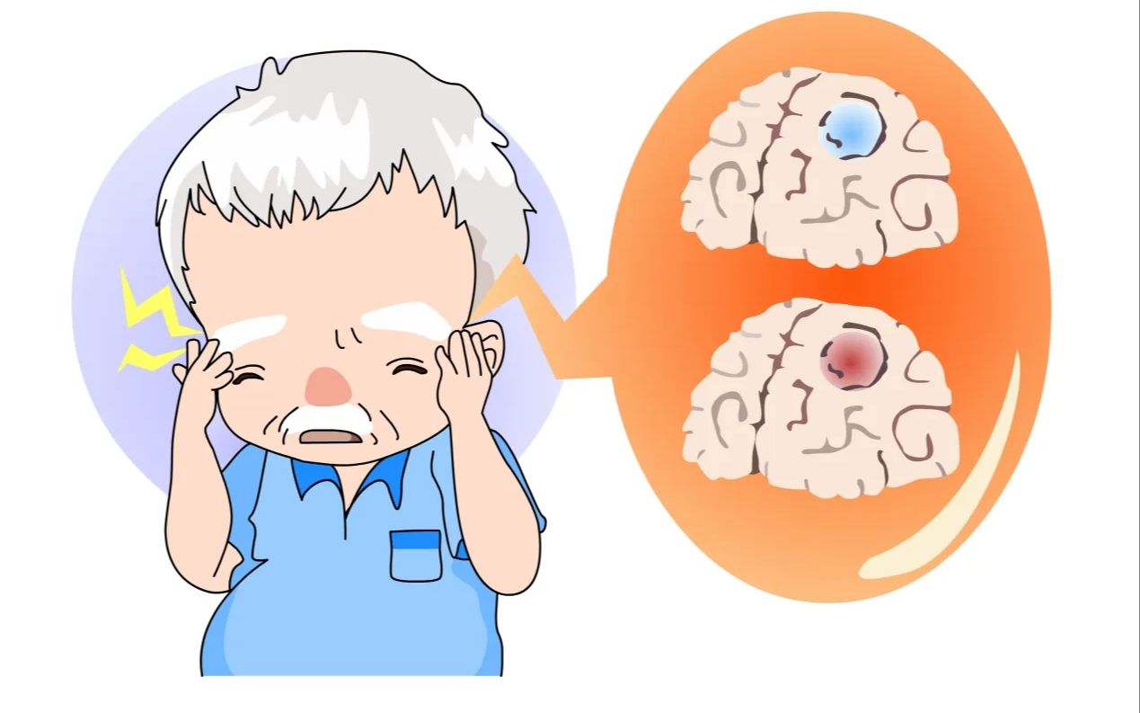 头晕昏沉就是脑供血不足？不一定，头晕超过3个月，病因70％可能是它